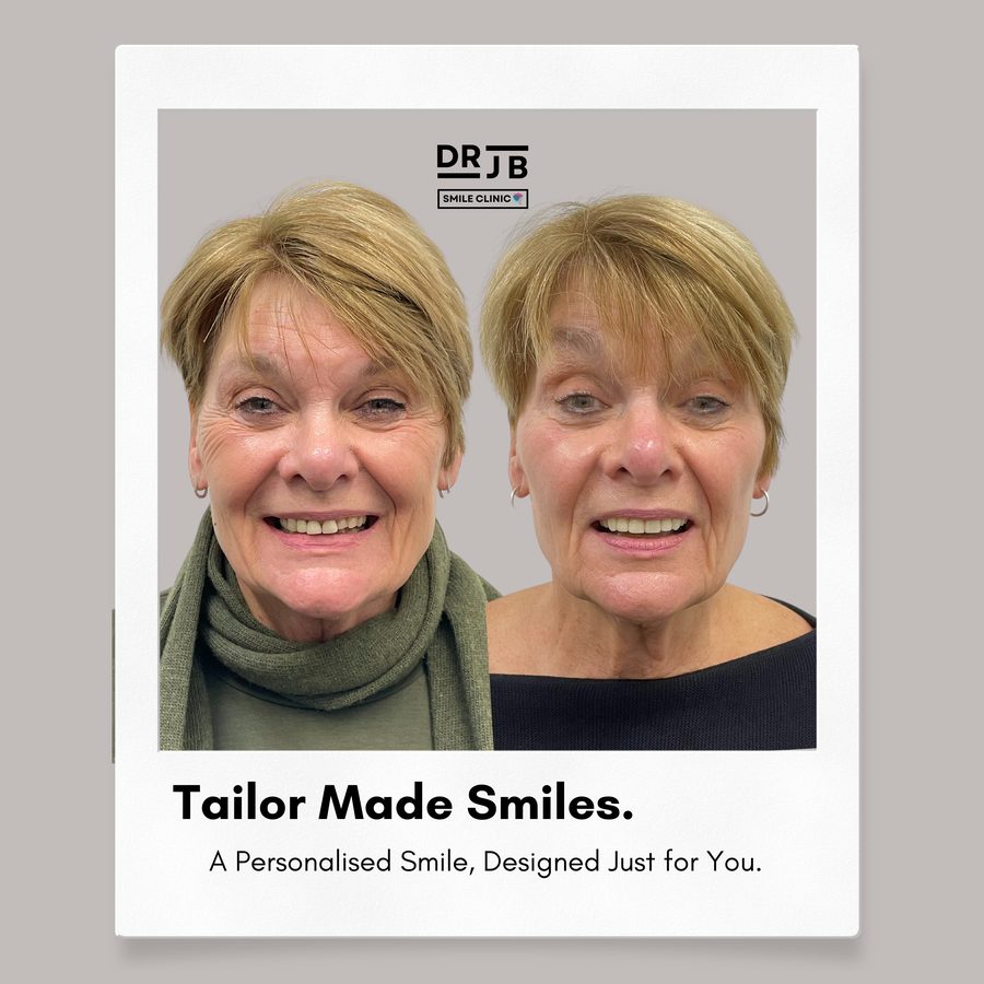 Before and after a personalised smile design treatment plan, DRJB Smile Clinic