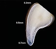 Cross-section of a tooth showing enamel thickness varying from 0.3mm to 0.7mm