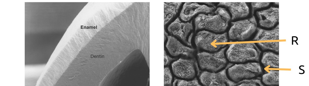 Scanning electron microscope image showing enamel, dentine and pulp structure, and the rod and sheath network within enamel